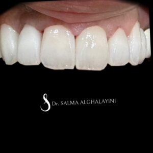 قبل وبعد 9